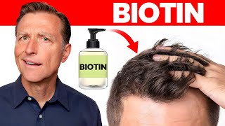 Does Biotin or Biotin Shampoo Really Work for Hair Loss [upl. by Welby]