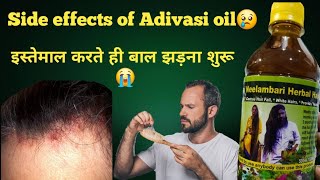 Side effects of Adivasi hair oil [upl. by Airamesor168]