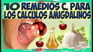 10 Remedios Caseros para Amígdalas  Remedios para los CALCULOS AMIGDALINOS [upl. by Nolahs]