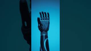 Exploring the Wonders of Prosthetic Hands [upl. by Igal]