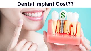 Full Mouth Dental Implants Cost and Comparison [upl. by Pollock]