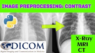 Preprocessing How to enhance the contrast of DICOM standard images  Python Programming [upl. by Anoif]