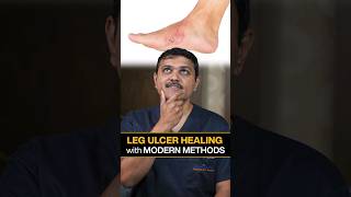 Revealed Innovative Ways to Heal LEG ULCERS Quickly legulcer shortsvideo vascularsurgeon [upl. by Alenas232]