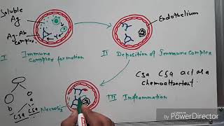 Type 3 hypersensitivity [upl. by Cilurzo]