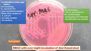 Sorbitol Macconkey Agar for screening E coli O157H7 [upl. by Kauslick]