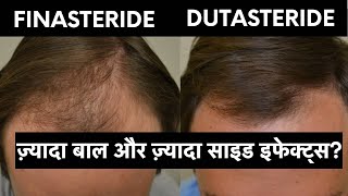 Finasteride vs Dutasteride in hindi  ये बातें कोई नहीं बताएगा [upl. by Colbert925]