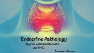 Endocrine Pathology  Hashimotos Thyroiditis lec 01 Pathology robbinsbasicpathology concept [upl. by Anoli451]