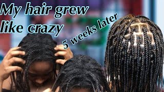 THIS IS HOW I DOUBLED MY HAIR GROWTH AFTER BIG CHOP mini braids for hair growth 2024 [upl. by Novah]