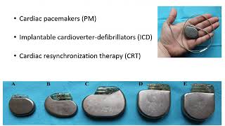 1 Basics of cardiac pacing introduction [upl. by Deeyn]