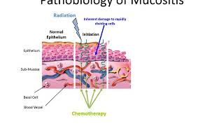 SGX942 Pathobiology of Mucositis animation [upl. by Habas]