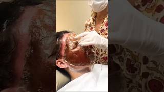 🔥Get Fair amp Spotless Skin Easily  Remove Suntan amp Pigmentation Naturally✅ytshorts skincare viral [upl. by Alesiram715]