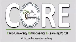 classification of perthesdisease and indications of surgical treatment [upl. by Fronnia]