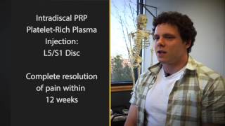 PRP Therapy for Disc Tear in Back  Patient Testimonial  Portland OR [upl. by Persian]