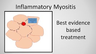 Myositis Inflammatory Myopathy Treatment [upl. by Aeniah]