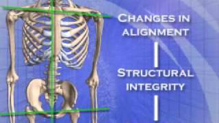 Chiropractor Goldsboro NC  Atlas Orthogonal Chiropractic Specialty at Chiropractic First [upl. by Astrix]