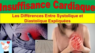 Insuffisance Cardiaque Congestive  Causes Symptômes et Traitements Avancés [upl. by Nahshon690]