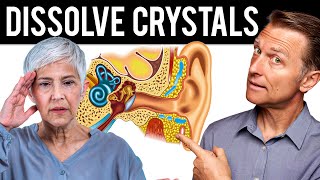 How to Dissolve Crystals in the Inner Ear and Get Rid of Vertigo [upl. by Hera]