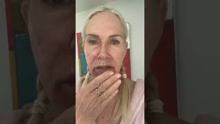 Fluorouracil treatment to lips and face [upl. by Hestia960]