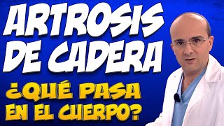 ARTROSIS DE CADERA  ¿Qué pasa en el cuerpo de quienes la padecen [upl. by Bore]