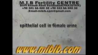 epithelial cells in female urine [upl. by Schwenk]