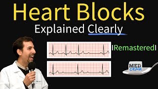 Heart Blocks Explained  First Second Third Degree and Bundle Branch on ECG [upl. by Bowen745]