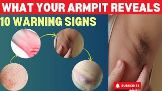 What Your Armpit Tells About Your Health 10 Warning Signs  Lump  Lymph Nodes  Painful Armpit [upl. by Toogood]