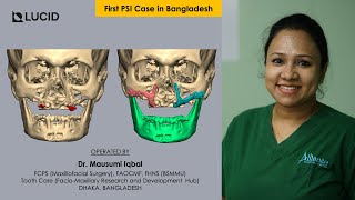 Atrophic Maxilla Rehabilitation with Titanium PSI  First Case in Bangladesh [upl. by Azile]