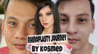 VLOG 39 MY RHINOPLASTY JOURNEY BY KOSMED rhinoplasty rhinoplastybeforeandafter [upl. by Quenna]