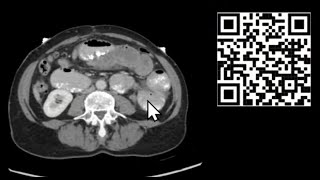 Mastering CT Abdomen and Pelvis Emergency Course [upl. by Zacks220]