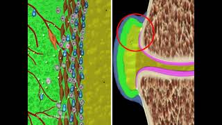 Rheumatoid arthritis synovial fibroblasts RASFs  Rheumatology Dictionary [upl. by Onairda]