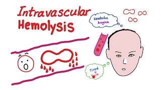 Intravascular Hemolysis [upl. by Alisen]