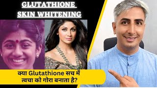 क्या Glutathione सच में त्वचा को गोरा बनाता है Does Glutathione Really Whiten Skin Dr Manoj Das [upl. by Riccardo452]