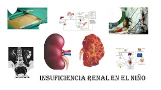 Insuficiencia Renal Crónica en el niño [upl. by Otiragram630]