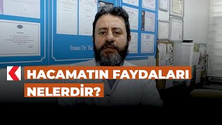 Hacamatın faydaları nelerdir [upl. by Balliol659]