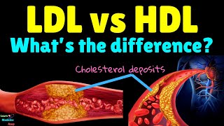 What’s the difference between LDL and HDL – LDL vs HDL  Bad Cholesterol vs Good Cholesterol [upl. by Tanitansy595]