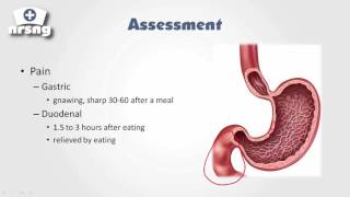 PUD Peptic Ulcer Disease Nursing NCLEX® Review  NRSNGacademycom [upl. by Eimak]