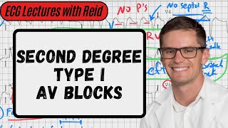 2nd Degree Type I AV Blocks  Day 5 ECG Challenge [upl. by Erdnassac]