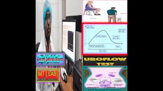 Urine test Uroflowmetry Bangla Uroflowmetry interpretation Urine Uroflowmetry [upl. by Dante989]