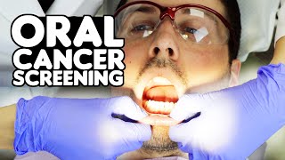 How Oral Cancer Screenings Are Performed [upl. by Ettelloc863]