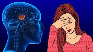 Pituitary Gland Disorders Symptoms And Treatment [upl. by Yasmine511]