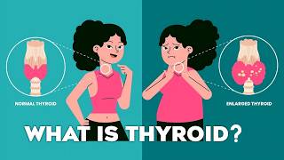 Thyroid Gland T3 T4 Thyroid Hormones and Thyroid Problems Animation thyroid [upl. by Yanal165]