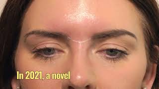 HowTo Treat The Glabella With Botox  3 Point Injecting Technique  Dr Chris Hutton [upl. by Domel]