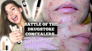 THE BEST ACNE COVERAGE CONCEALER IN THE DRUGSTORE the winner is  NYX Elf Essence Covergirl [upl. by Tufts]