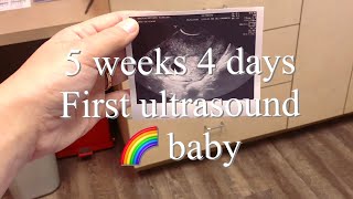 5 Weeks Pregnant  Week By Week Pregnancy [upl. by Natsirhc457]