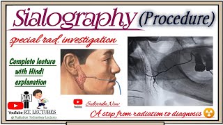 Sialography Procedure Complete Lecture Sialography radiology complete video Lecture in hindi [upl. by Edualc660]