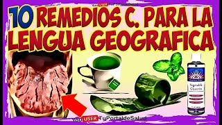 10 Remedios Caseros para la Lengua Geográfica  Remedio para Glositis Migratoria Lengua Fisurada👅 [upl. by Yllor]