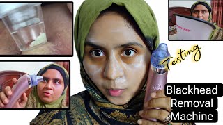 Blackheads Removal Machine Testing Vacuum Blackhead Remover Electric Face Pore Cleanersunialife [upl. by Milah]