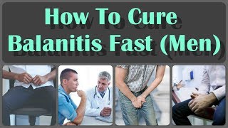 How To Cure Balanitis With Oils Fast And Causes Symptoms And Treatment Of Balanitis [upl. by Folsom]