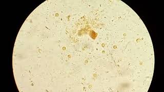 Blastocystis spp ¿Protozoario o chromista [upl. by Helyn574]