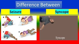 Difference Between Seizure and Syncope [upl. by Alleinad795]